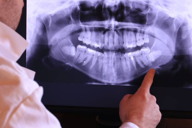 Best Emergency Dental Extractions in New Martinsville, WV
