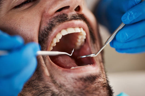 Best Emergency Dentist for Knocked-Out Tooth in New Martinsville, WV